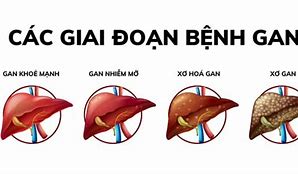 Bạn Đã Biết Những Gì Về Bệnh Của Gan